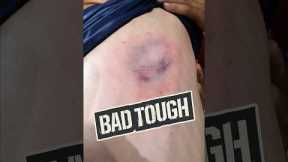 BEANED by 98 mph…TWICE IN ONE AT BAT?! 😱🤯